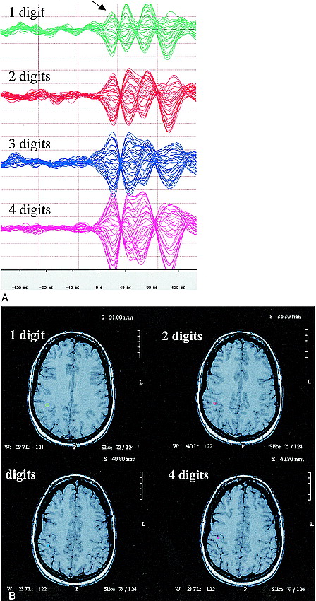 fig 2.