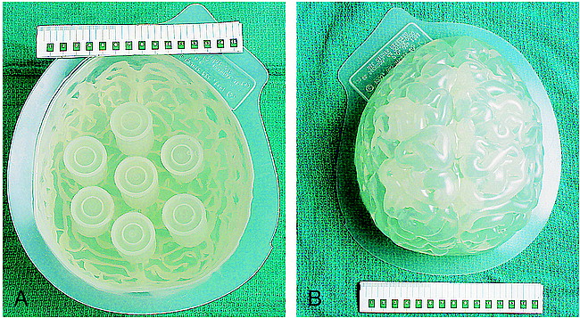 fig 1.