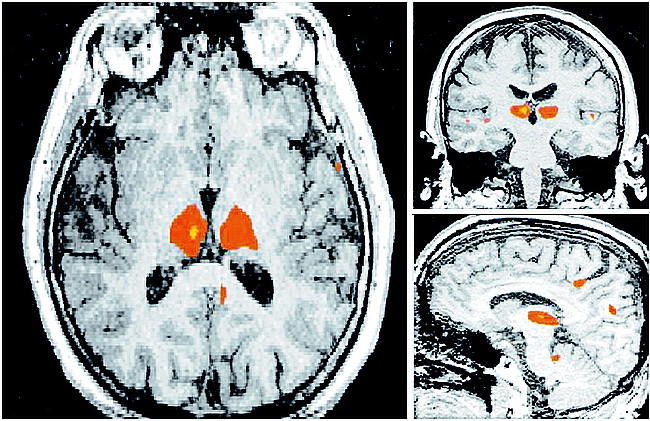 fig 3.