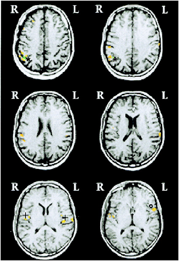 fig 2.