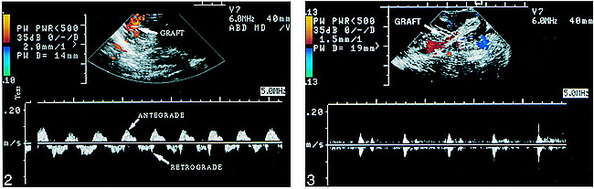 fig 3.