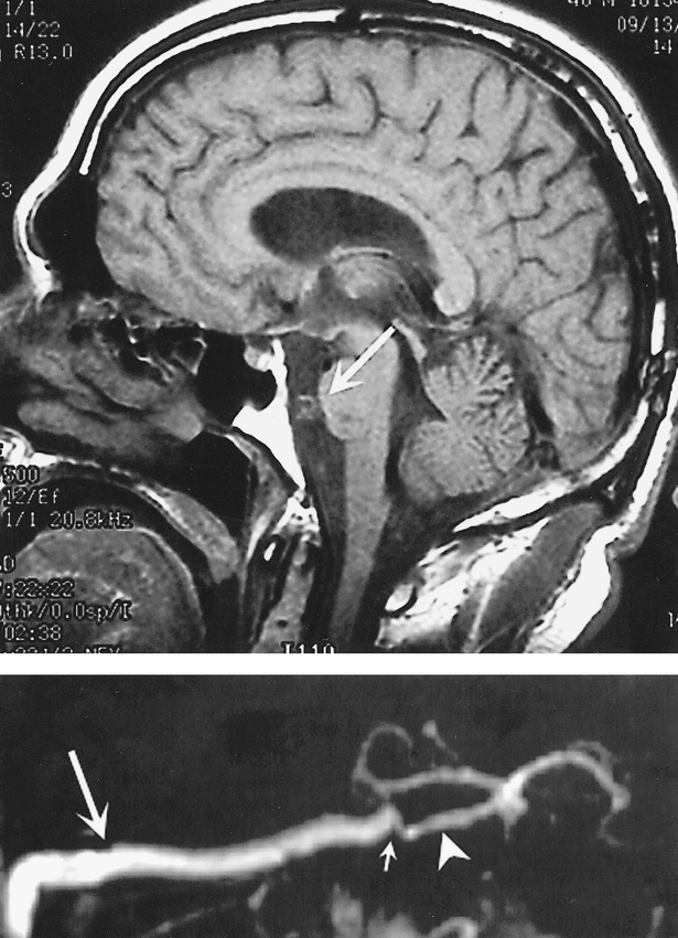 fig 4.