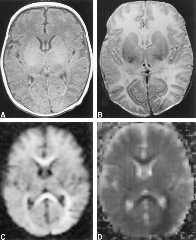 fig 1.