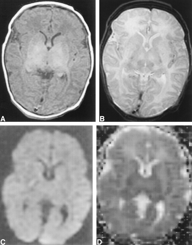 fig 2.
