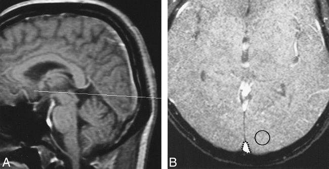 fig 1.