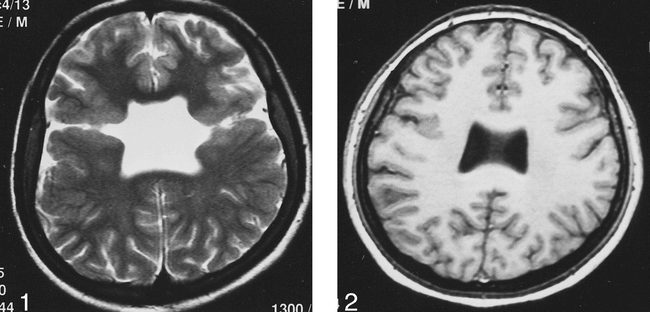 fig 2.