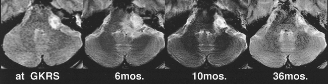 fig 10.