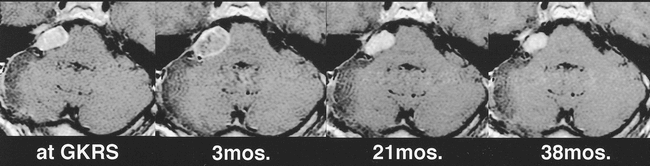 fig 3.