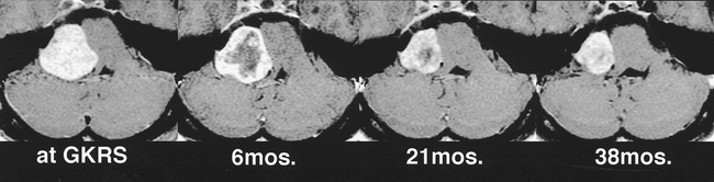 fig 4.