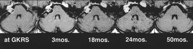 fig 5.