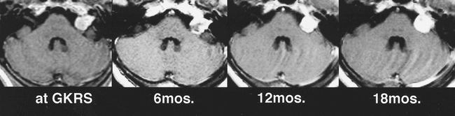 fig 6.