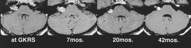 fig 7.