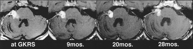 fig 8.