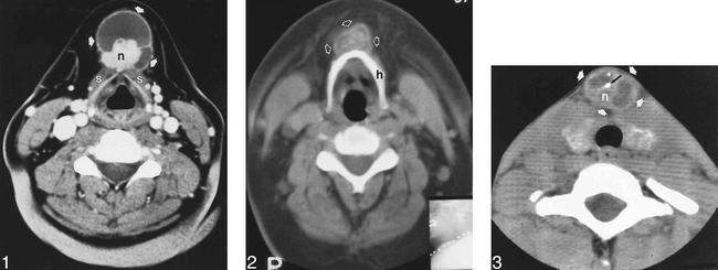 fig 2.