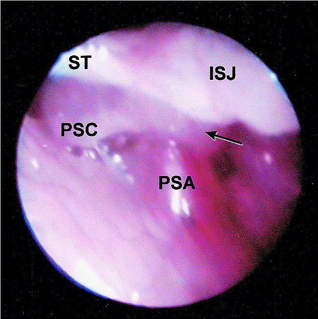 fig 3.