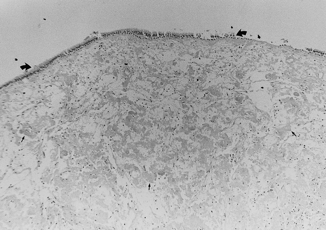 fig 2.