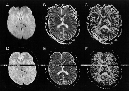 fig 1.