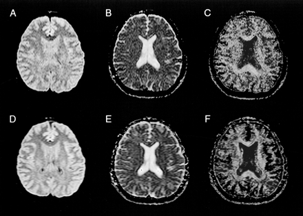 fig 3.