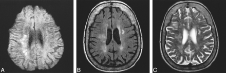fig 2.
