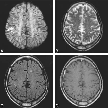 fig 4.