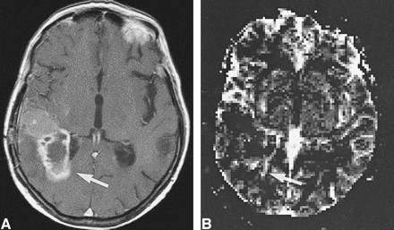 fig 6.