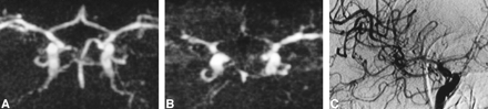 fig 1.
