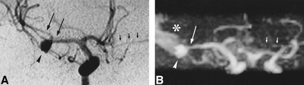 fig 2.