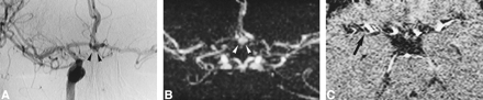 fig 3.