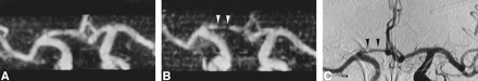 fig 4.