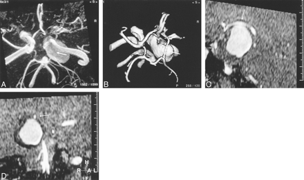 fig 2.