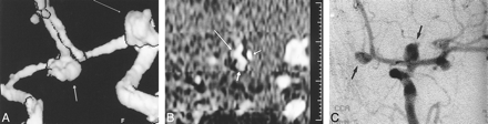 fig 3.