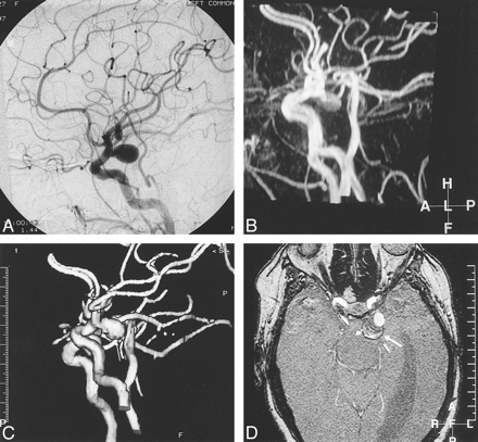 fig 4.