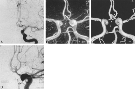 fig 5.