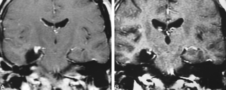 fig 2.