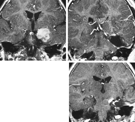 fig 4.