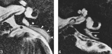 fig 3.