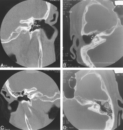 fig 1.