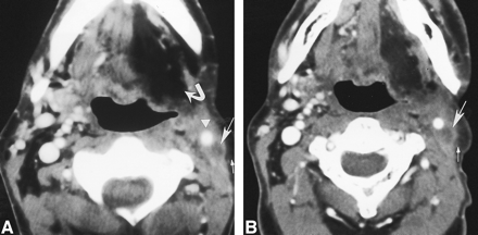 fig 2.