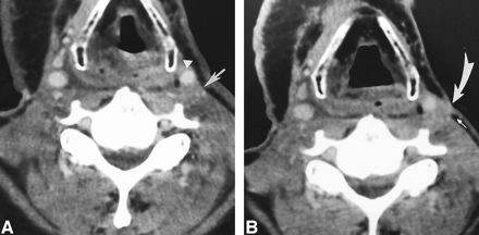 fig 5.
