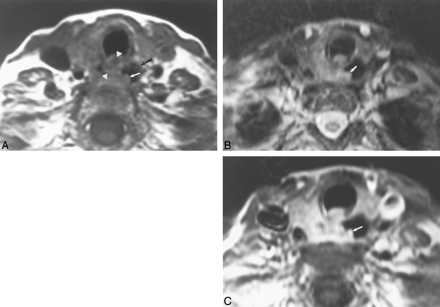 fig 2.