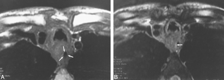 fig 3.