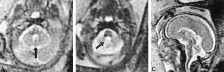 fig 2.