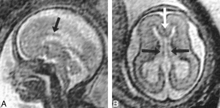 fig 5.