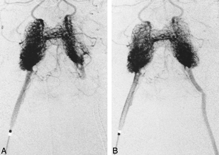 fig 3.