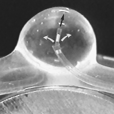 fig 1.