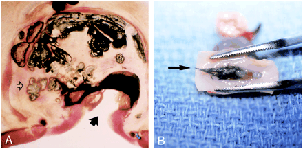 fig 2.