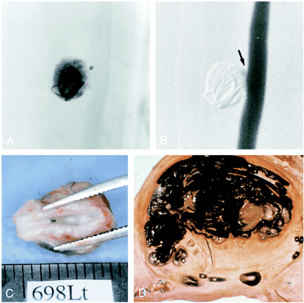 fig 3.