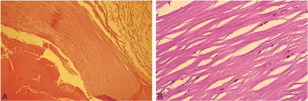 fig 1.