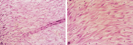 fig 2.