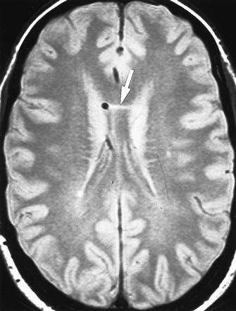 fig 1.